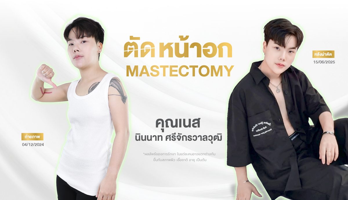 ตัดหน้าอก 3. ผลลัพธ์ที่คาดหวังได้