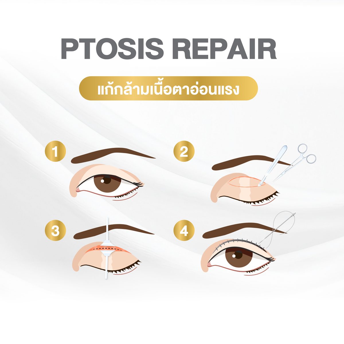 Website - info เทคนิคกรีดตา 2 ชั้น-05_0.jpg