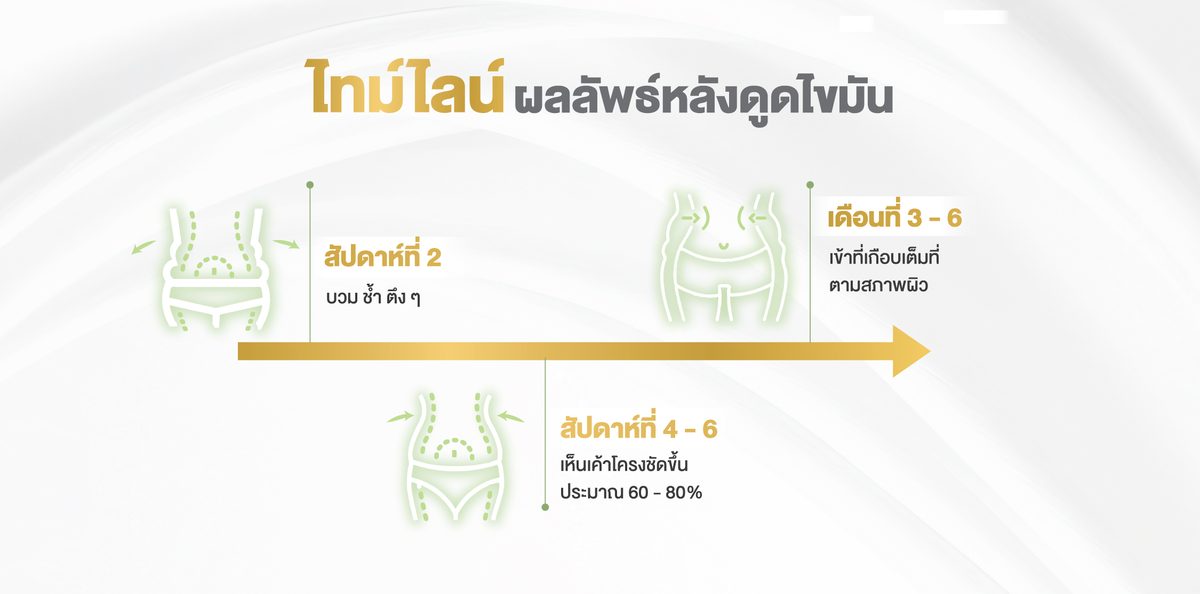 Website---ไทม์ไลน์ผลลัพธ์หลังดูดไขมัน.jpg