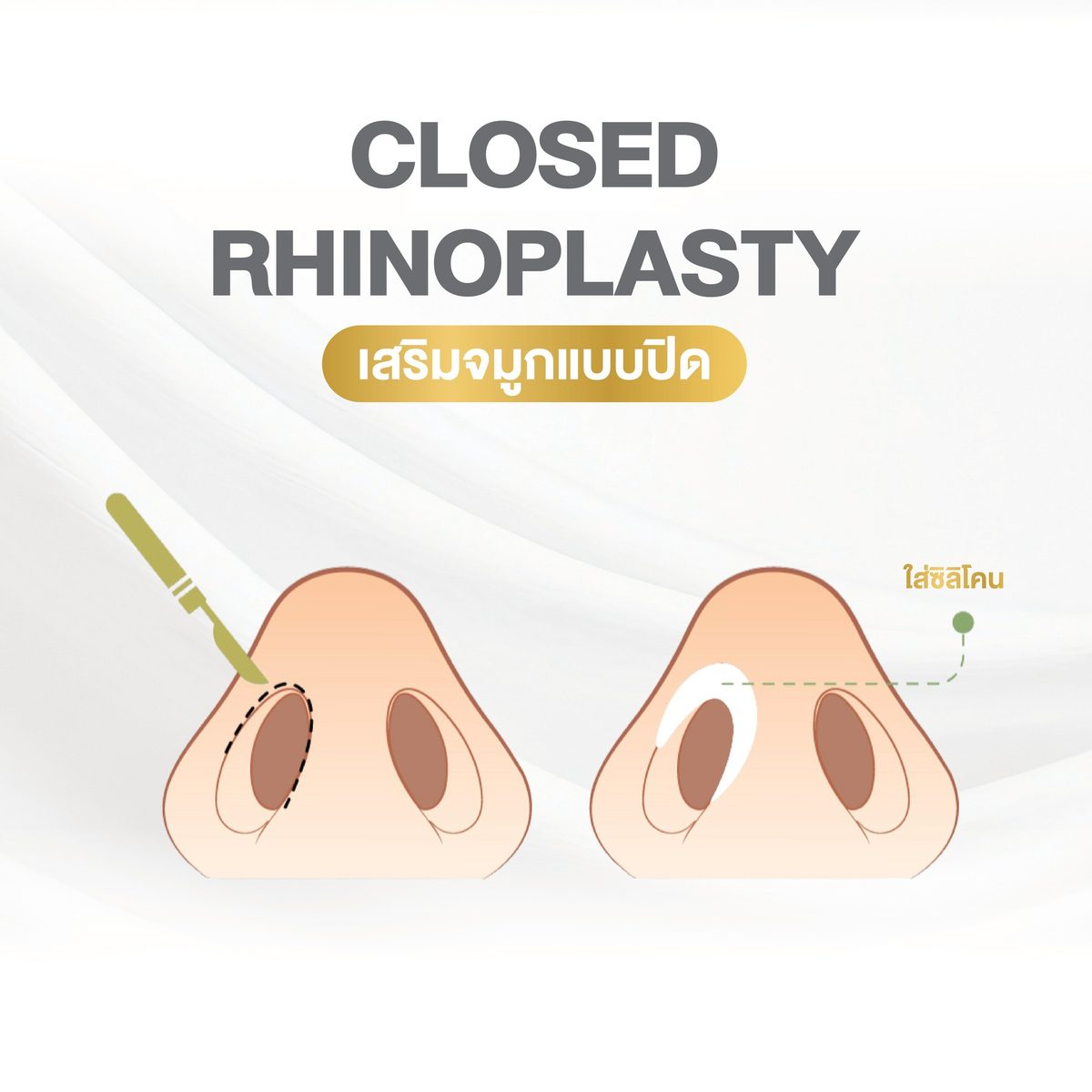 Website - info 3 เทคนิคจมูก-01.jpg