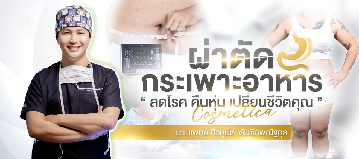 ตัดกระเพาะ