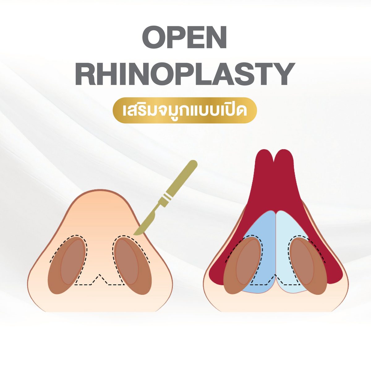 Website - info 3 เทคนิคจมูก-03.jpg