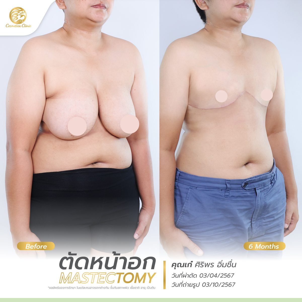 BF-AT--เก๋-ศิริพร-อิ่มชื่น-ตัดหน้าอก.jpg