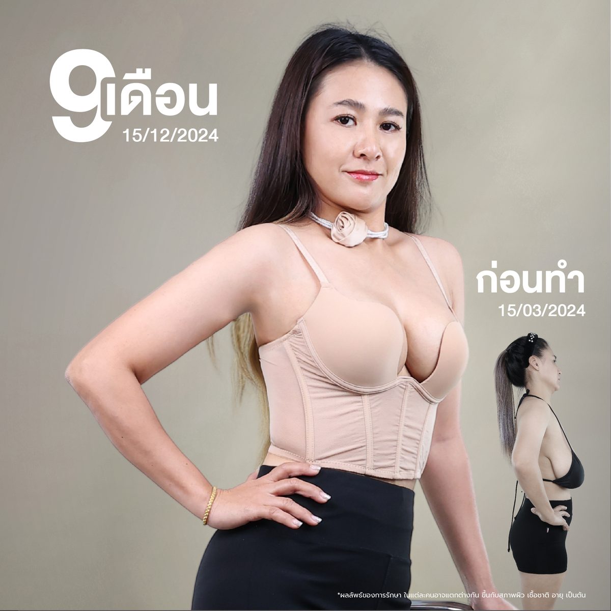 Album น้ำ ณัฏฐวิตรา Breat Lift-04 (1).jpg