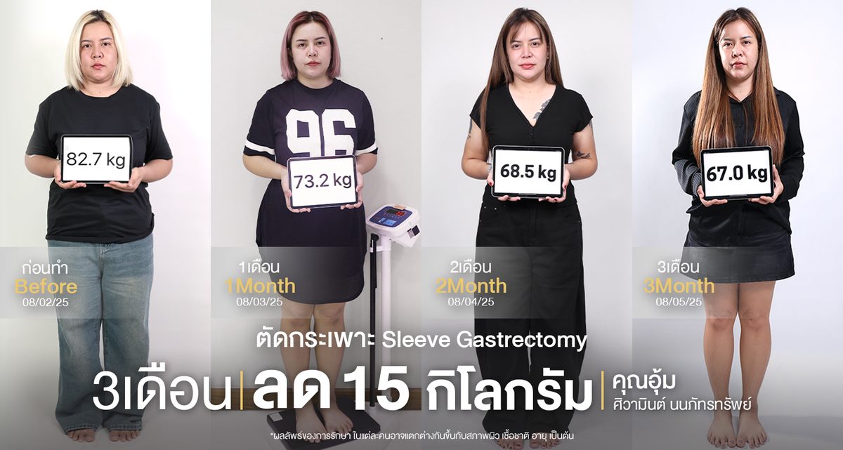 ตัดกระเพาะ(อุ้ม-ศิวามินต์-นนภัทรทรัพย์)web.jpg