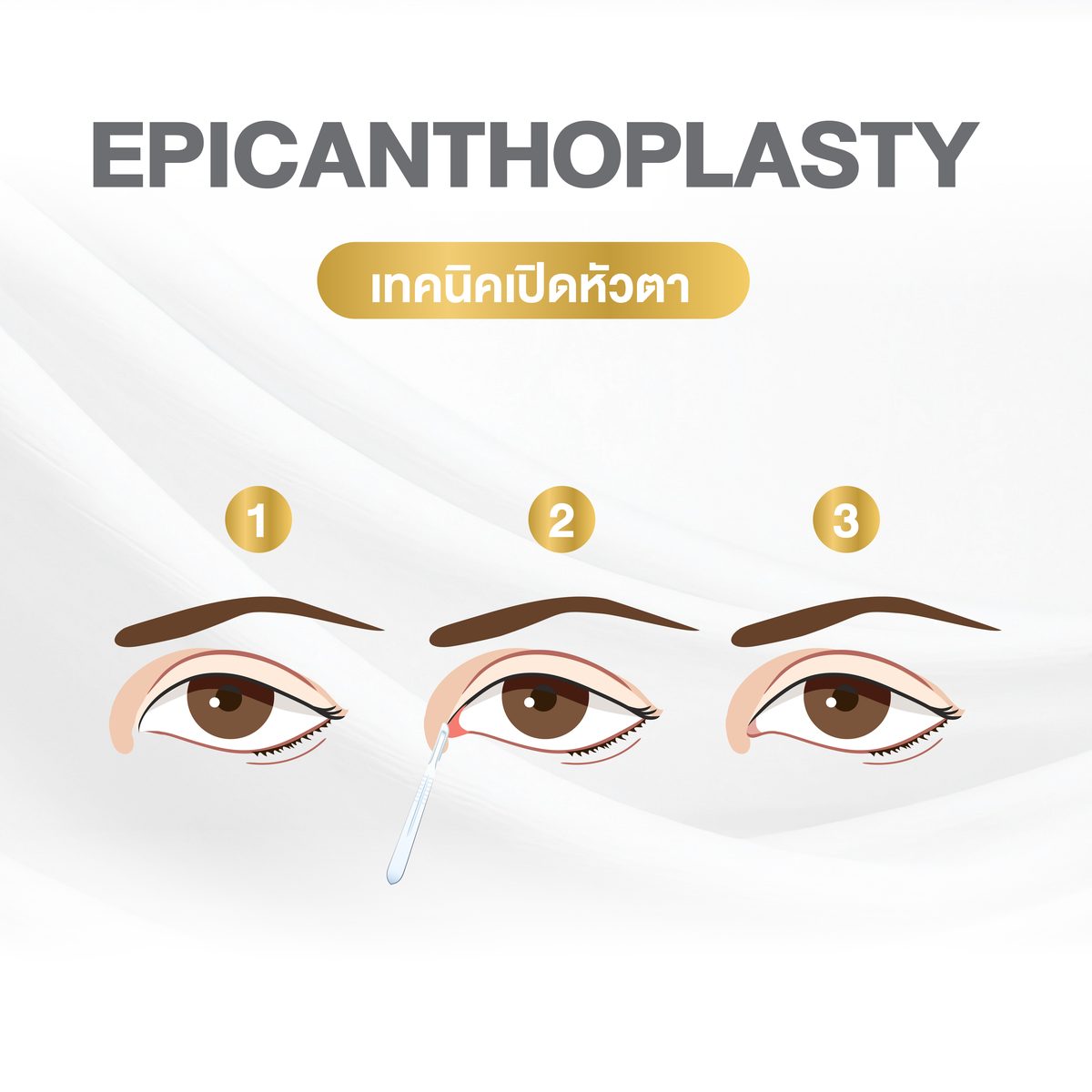 Website - info เทคนิคกรีดตา 2 ชั้น-03_0.jpg
