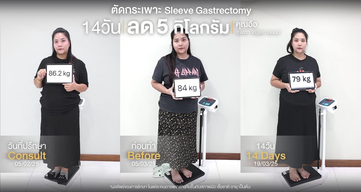 ตัดกระเพาะ-(อ้อ-สุจิตรา-จิรัฐติกาลนนท์)Web.jpg