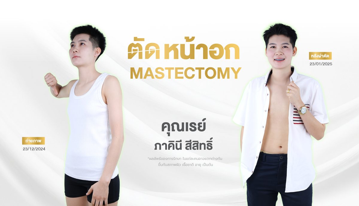 ตัดหน้าอก 3. ผลลัพธ์ที่คาดหวังได้
