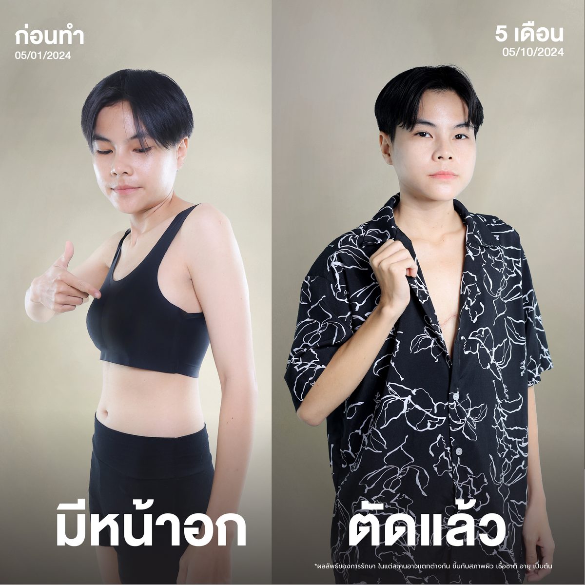 Album พอตเตอร์ ภนัชชา เทศสิงห์ ตัดหน้าอก-02.jpg