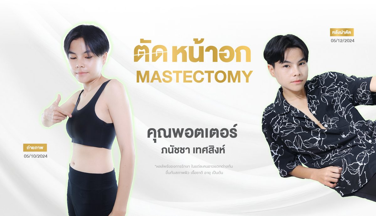 ตัดหน้าอก 3. ผลลัพธ์ที่คาดหวังได้