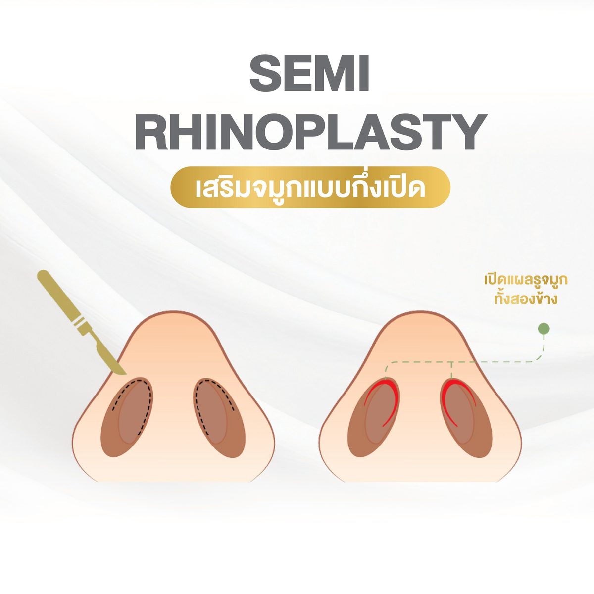 Website - info 3 เทคนิคจมูก-02.jpg