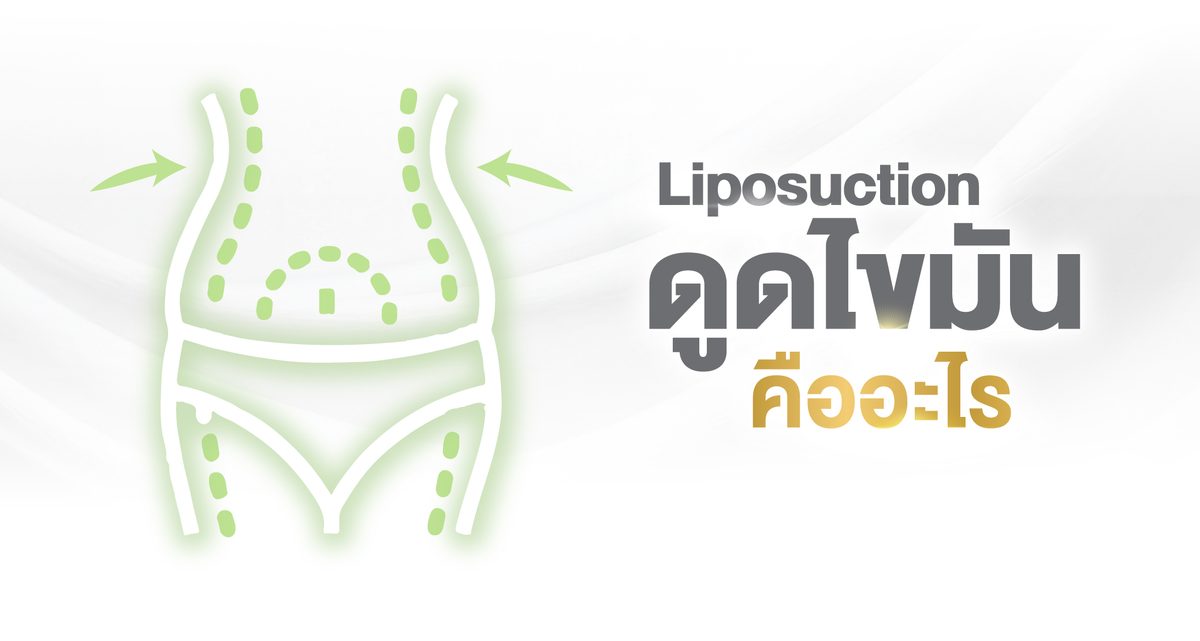 Website---ศัลยกรรมดูดไขมัน-คืออะไร.jpg