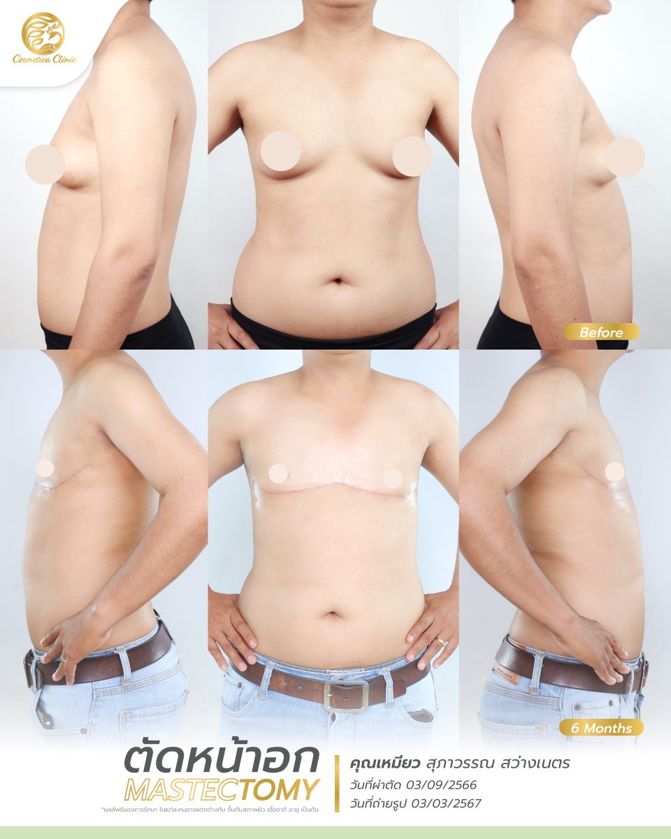 BF-AT-เหมียว-สุภาวรรณ-สว่างเนตร-ตัดหน้าอก.jpg
