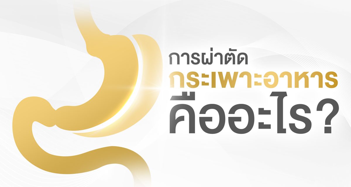 การผ่าตัดกระเพาะอาหารคืออะไร-(web).jpg